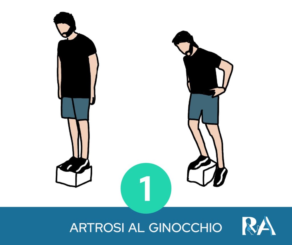 Esercizi artrosi ginocchio - equilibrio
